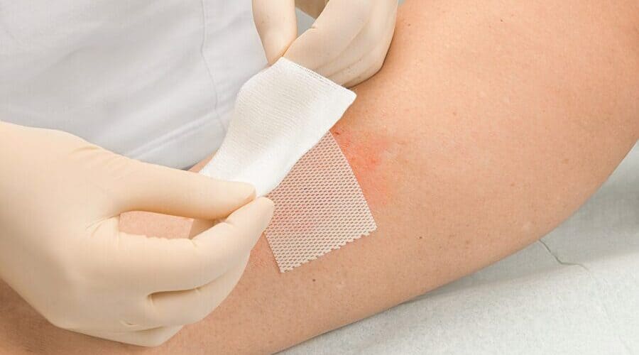 Как делать мазевые повязки разбираемся с Добрый Доктором